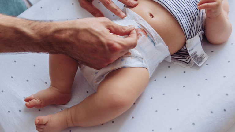 how to deal with diaper rash