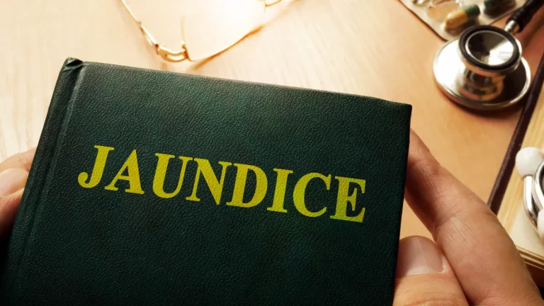 neonatal juandice in babies